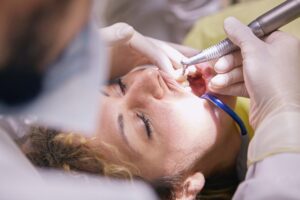 Dental Veneers - Wollongong - Ambience Dental