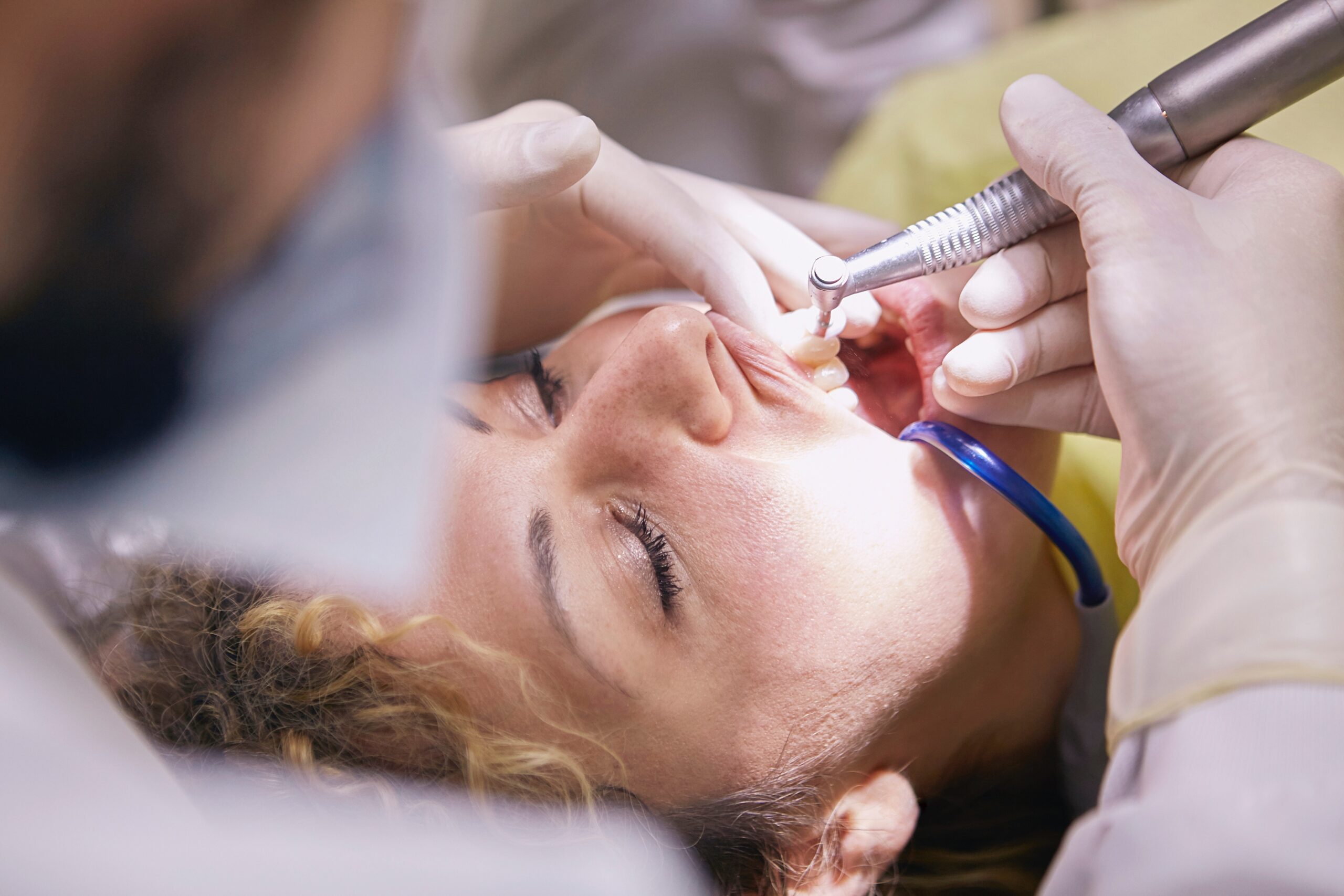 Read more about the article Dental Veneers: Is It Worth the Cost?